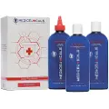 Mediceuticals Scalp Treatment Kit - Dandruff Scalp