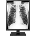LG Medical Diagnostic 3mp Skærm 60hz
